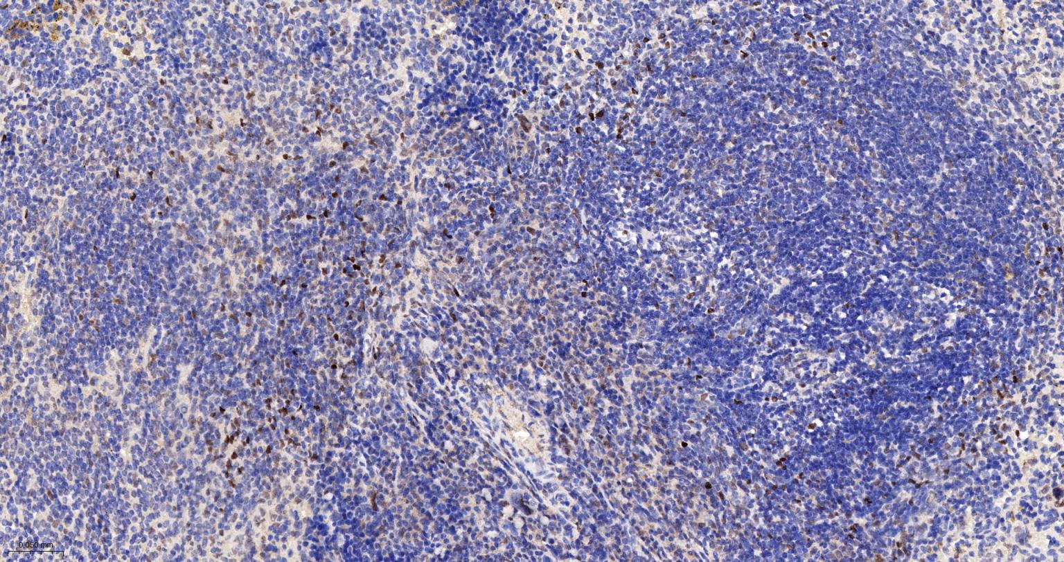 DNA甲基转移酶-3α重组兔单抗