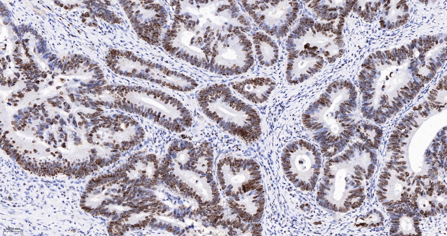 高迁移率族蛋白A1重组兔单抗