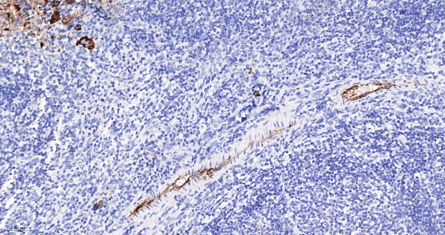 血管假性血友病因子重组兔单抗