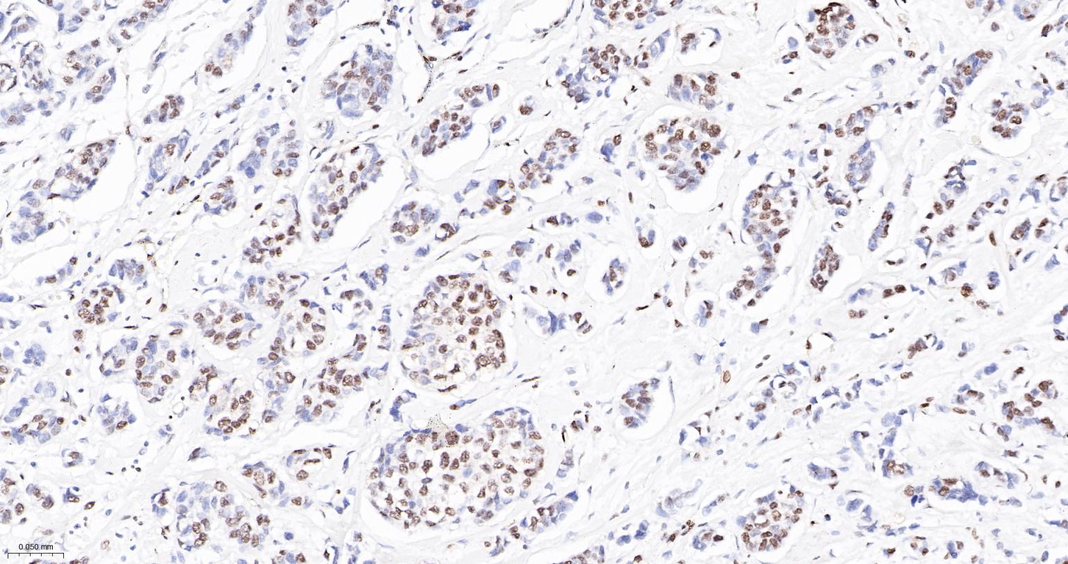 DNA解旋酶V重组兔单抗-bsm-60625R