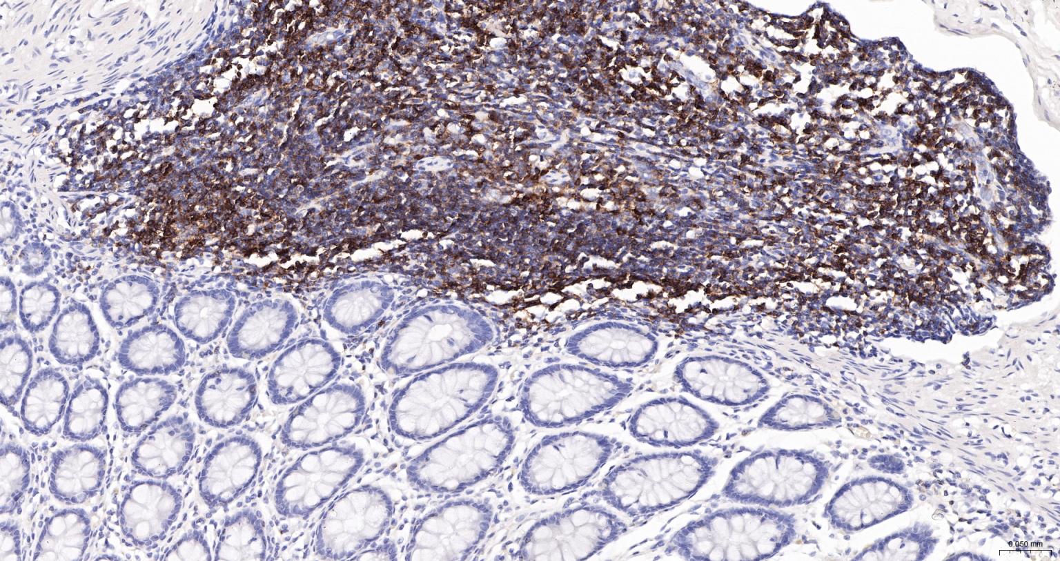 CD45 Recombinant Rabbit mAb, HRP conjugated (标记一抗) - WB,IHC-P,IHC-F | Bioss