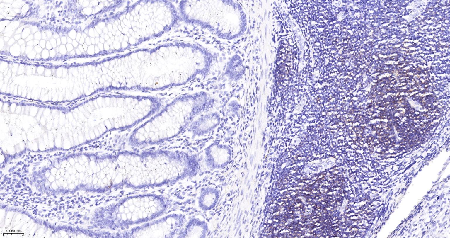 CD19重组兔单抗-bsm-60605R