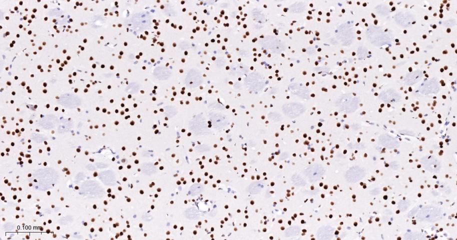 DNA解旋酶V重组兔单抗-bsm-60625R