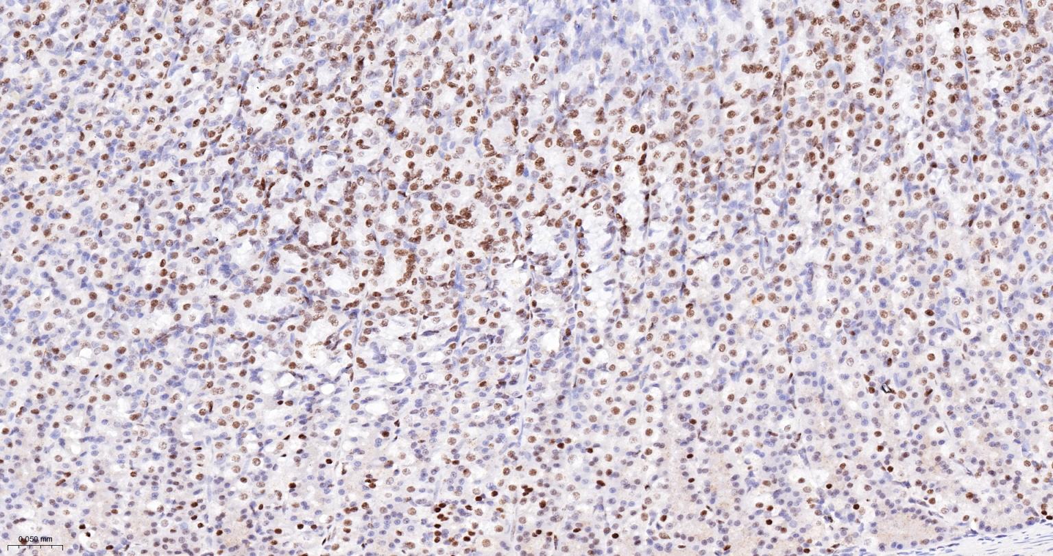 DNA解旋酶V重组兔单抗-bsm-60625R