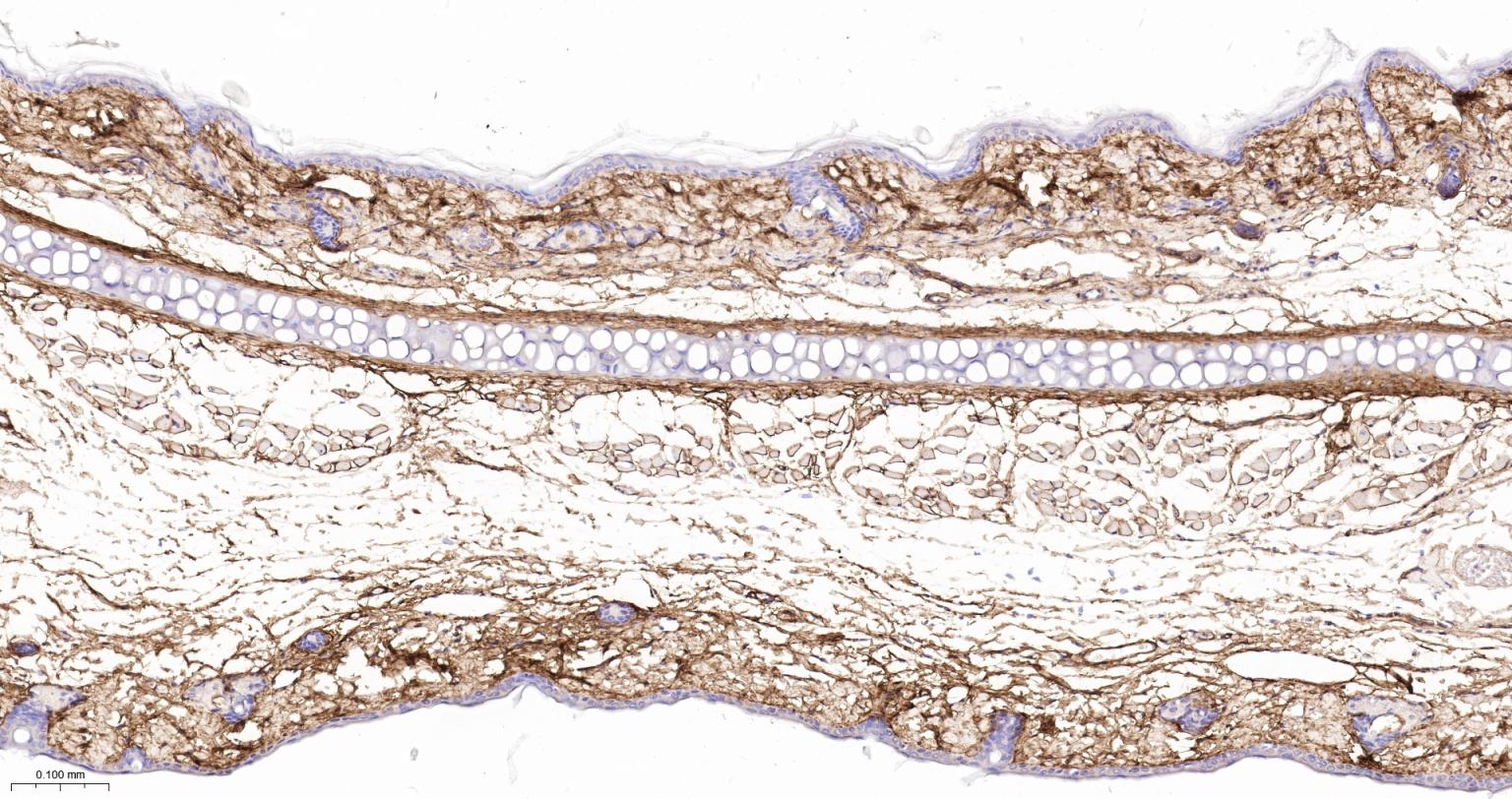 6型胶原重组兔单抗
