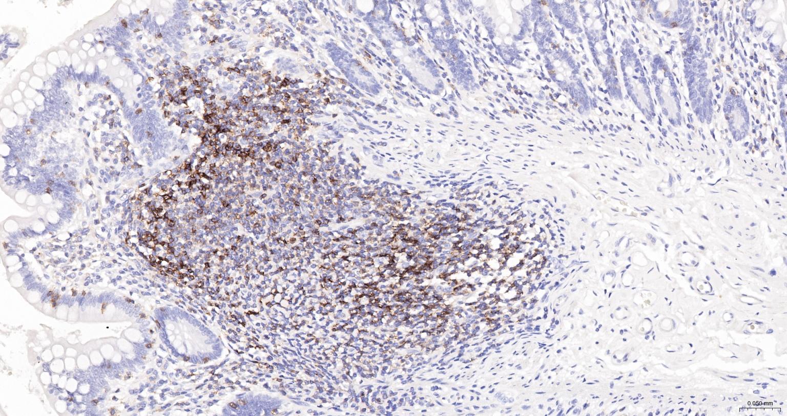 HRP标记的白细胞共同抗原CD45重组兔单抗-bsm-54757R-HRP