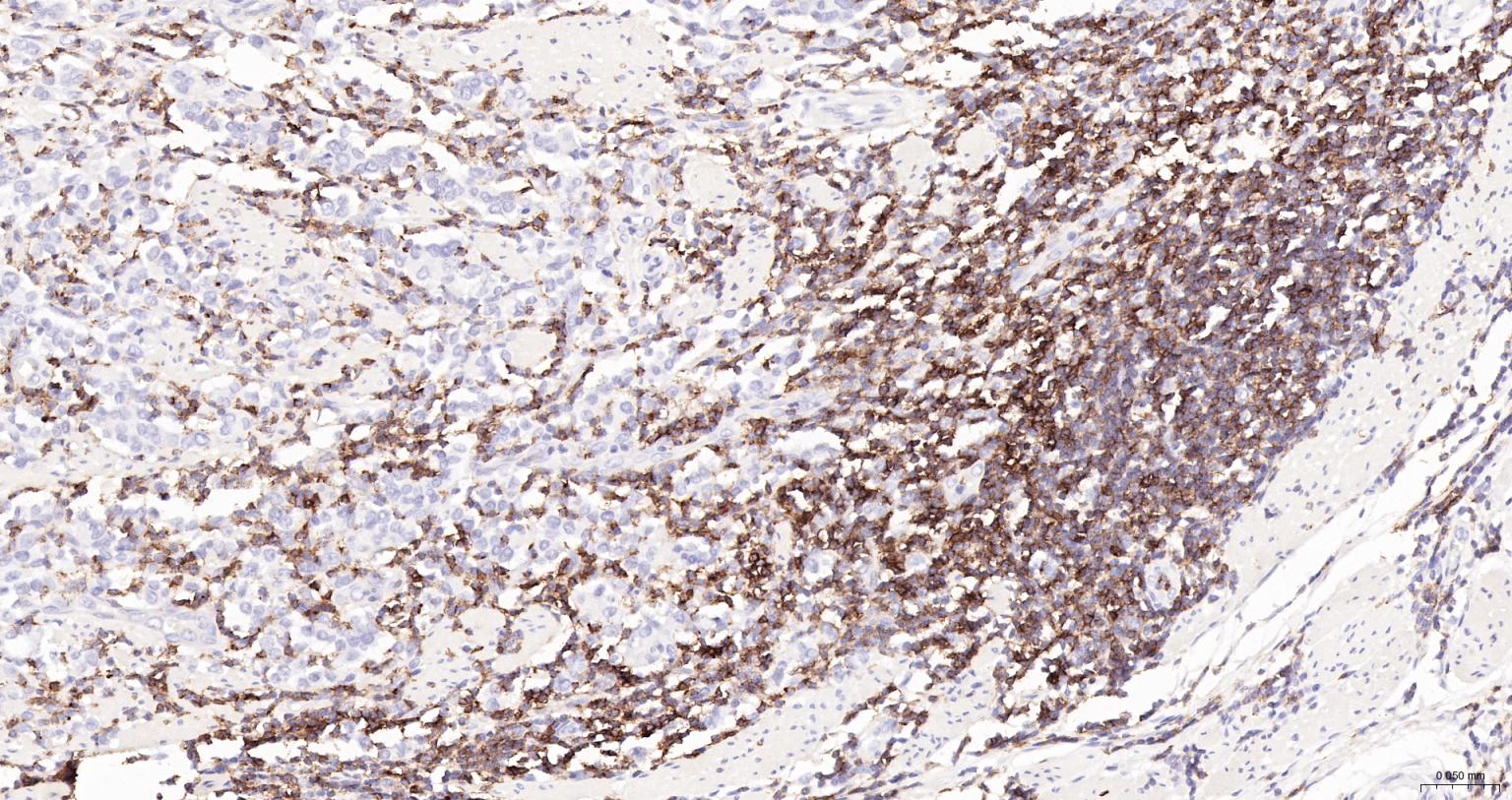 HRP标记的白细胞共同抗原CD45重组兔单抗-bsm-54757R-HRP