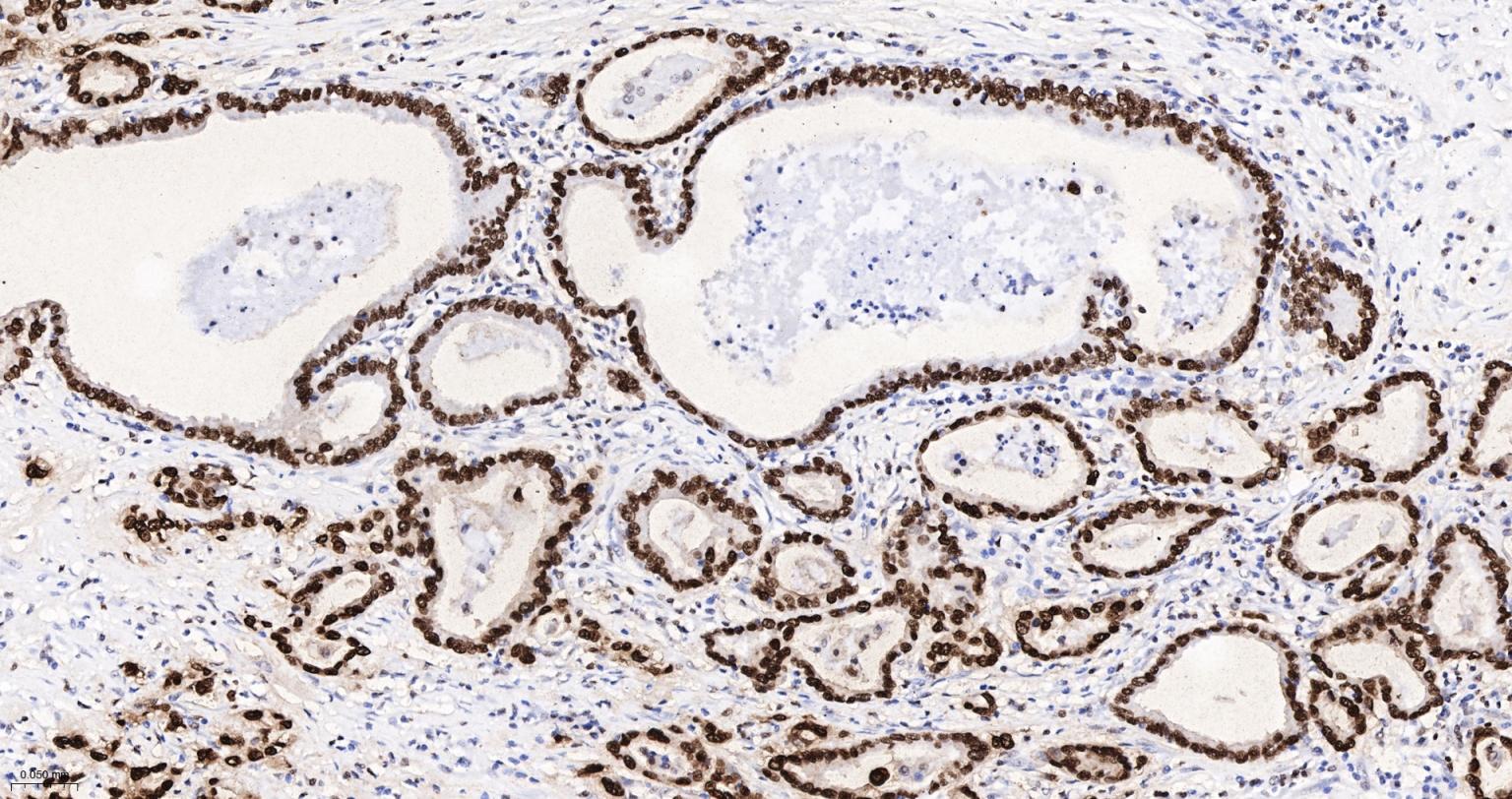 高迁移率族蛋白A1重组兔单抗