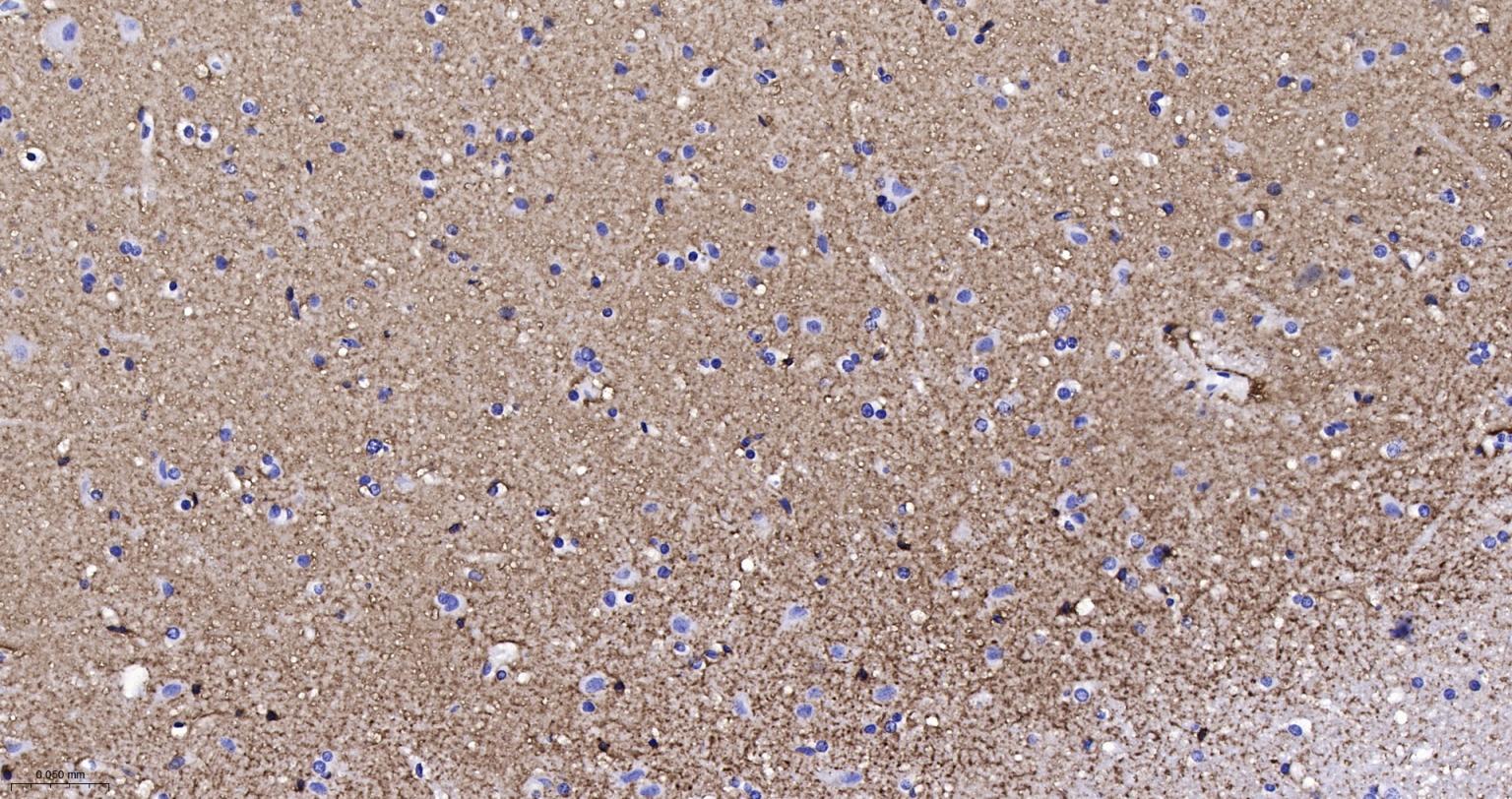 胶质细胞谷氨酸运载蛋白1重组兔单抗