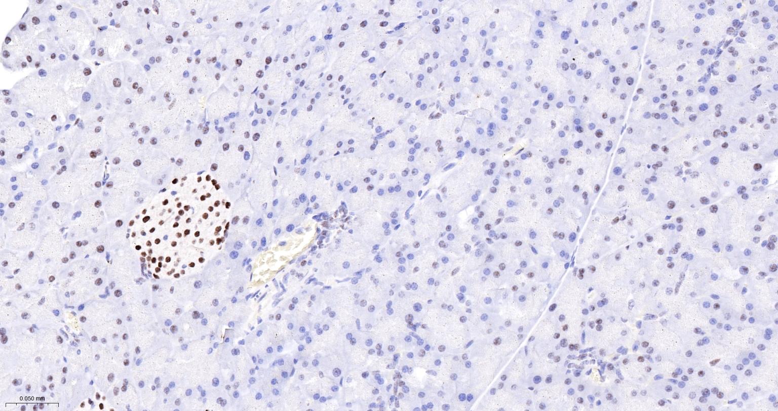 DNA解旋酶V重组兔单抗-bsm-60625R