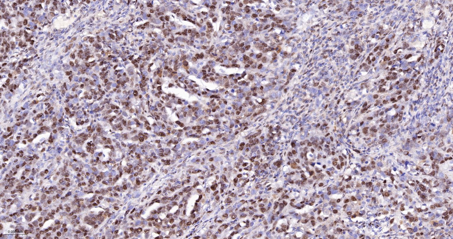 DNA解旋酶V重组兔单抗-bsm-60625R