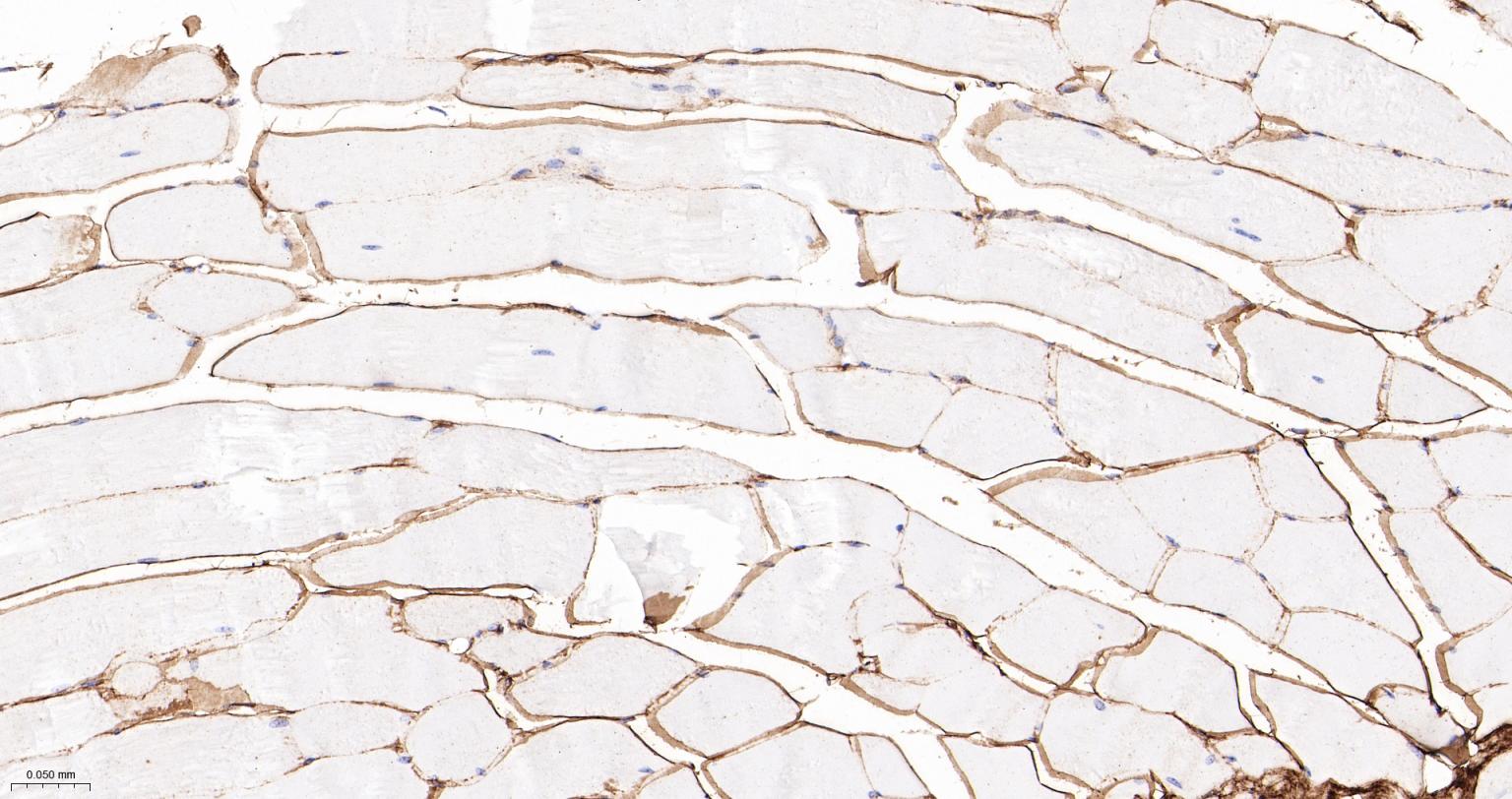 6型胶原重组兔单抗