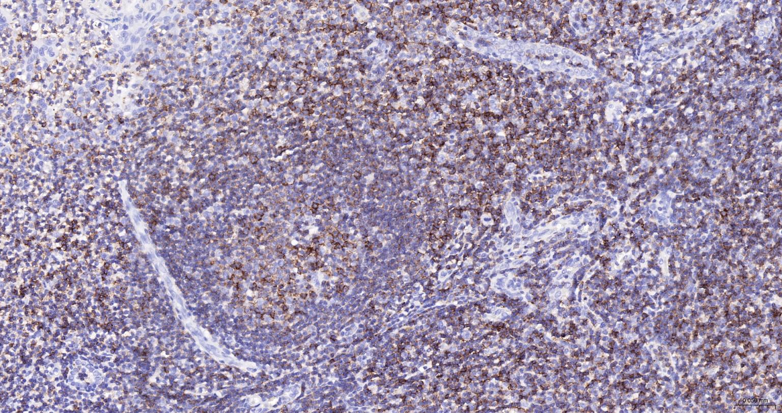 HRP标记的白细胞共同抗原CD45重组兔单抗-bsm-54757R-HRP