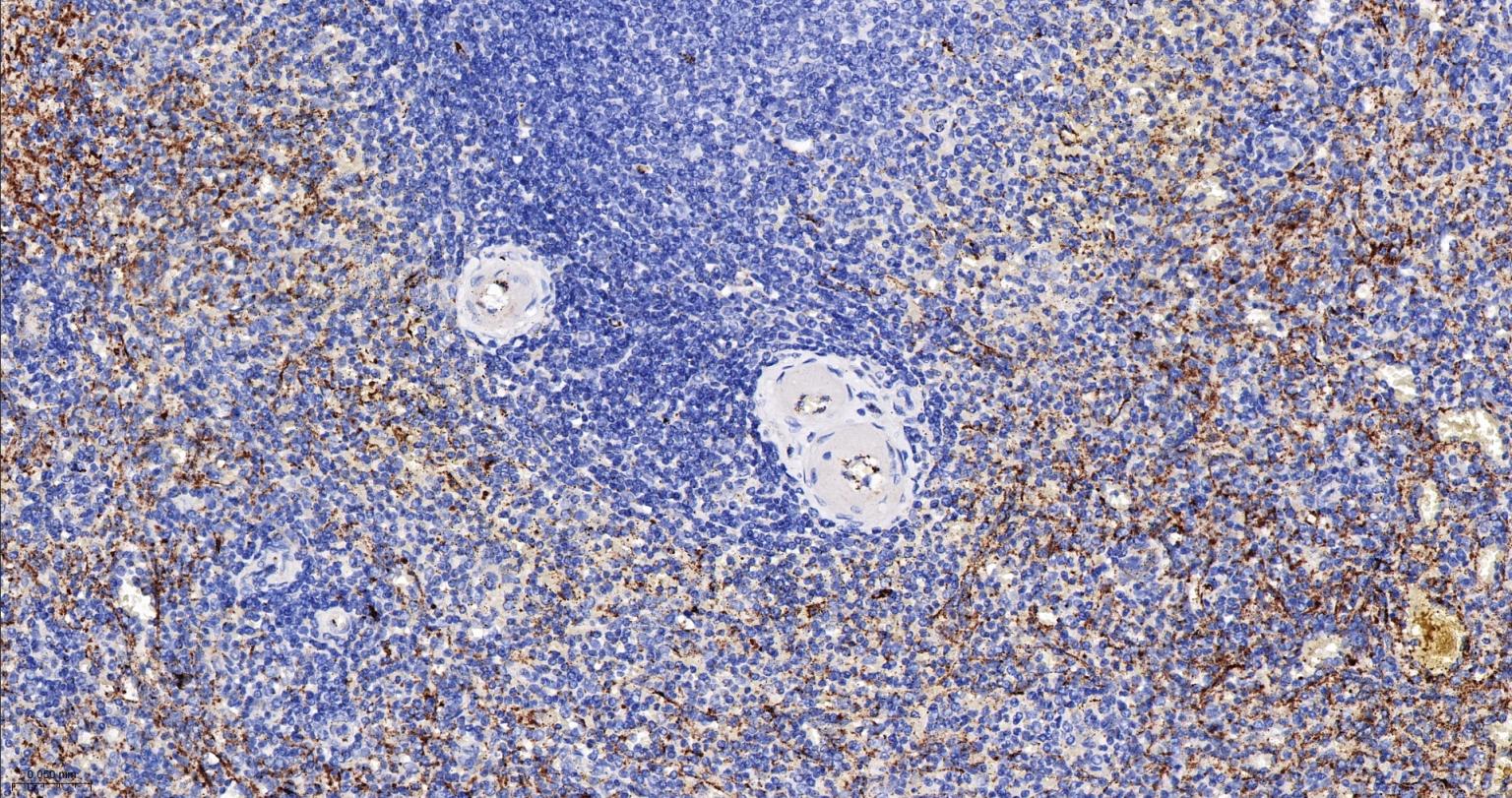 血管假性血友病因子重组兔单抗