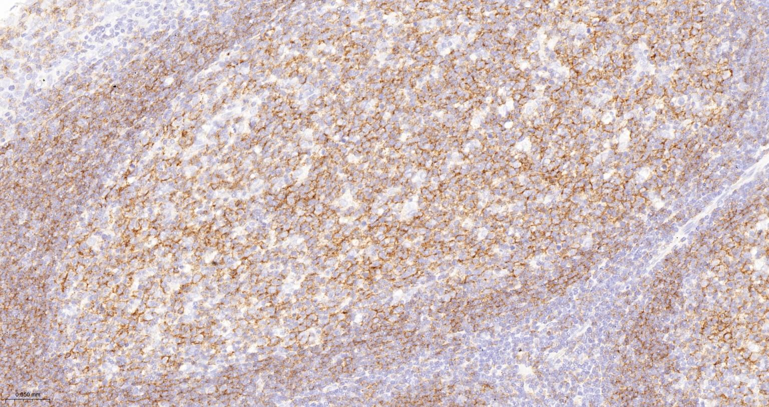 CD19重组兔单抗-bsm-60605R