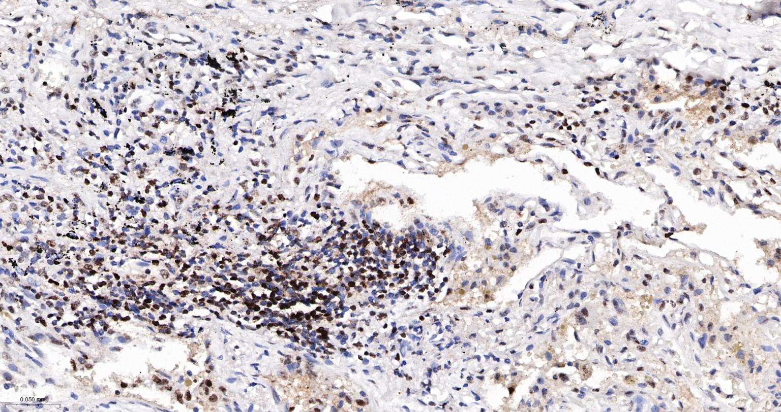 高迁移率族蛋白A1重组兔单抗