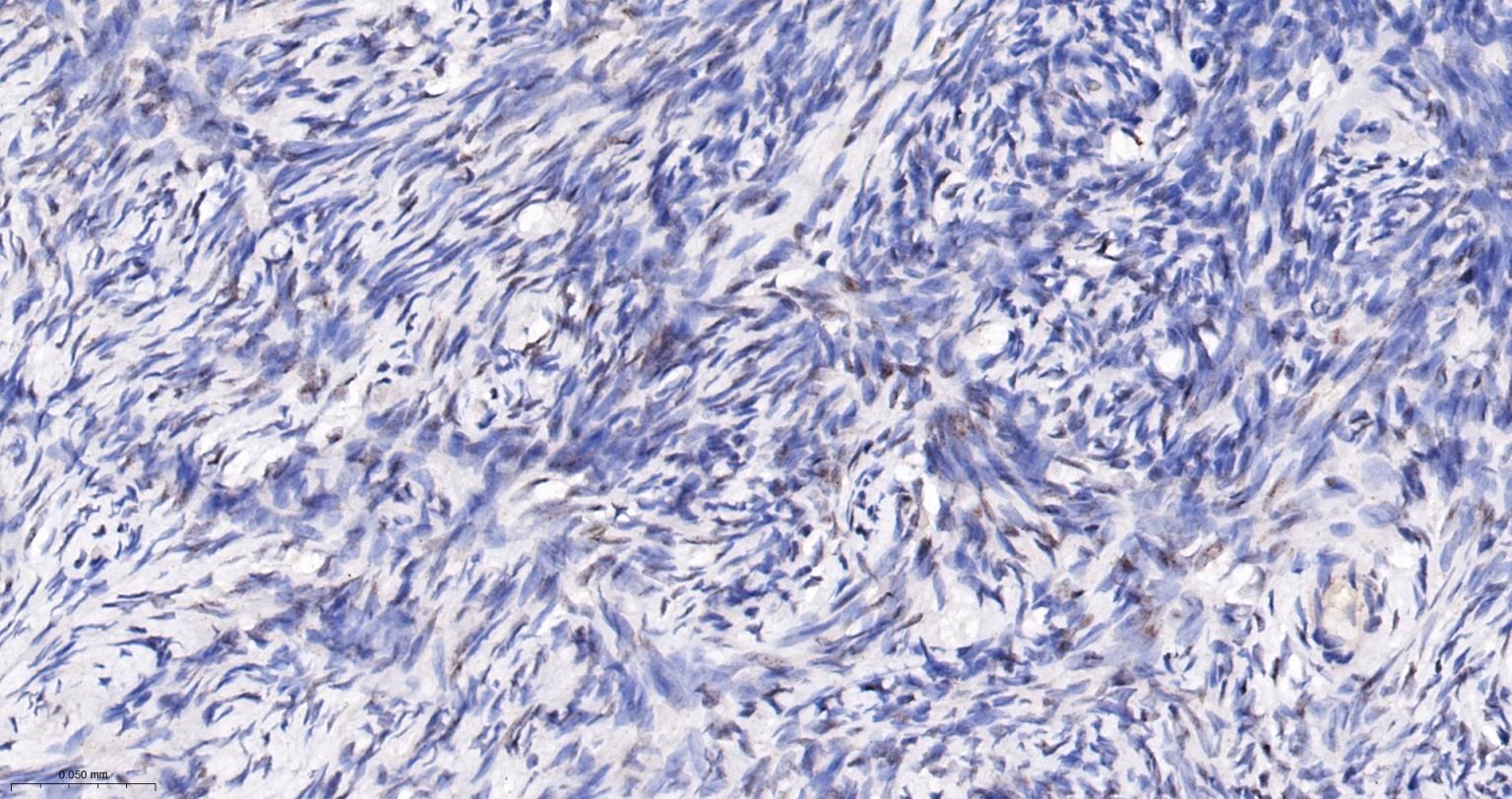 肾母细胞瘤蛋白重组兔单抗