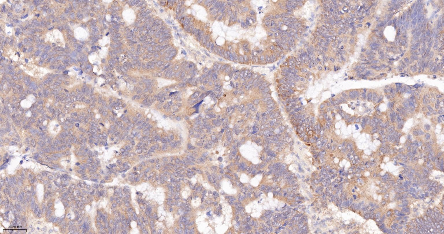 溶血磷脂酸受体蛋白1/EDG2重组兔单抗