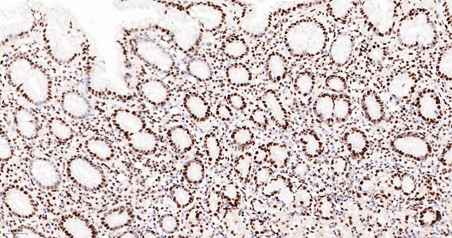 DNA解旋酶V重组兔单抗-bsm-60625R