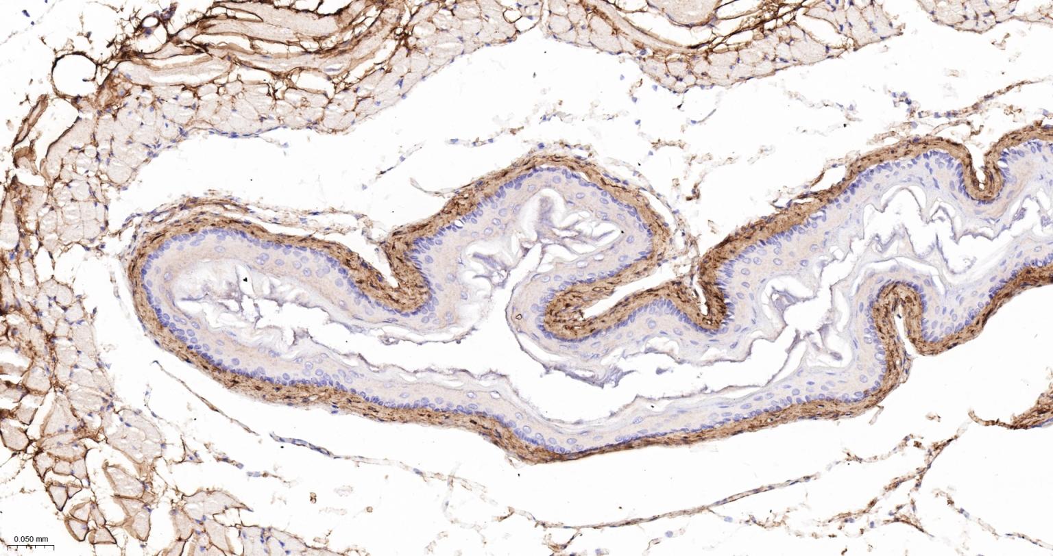 6型胶原重组兔单抗