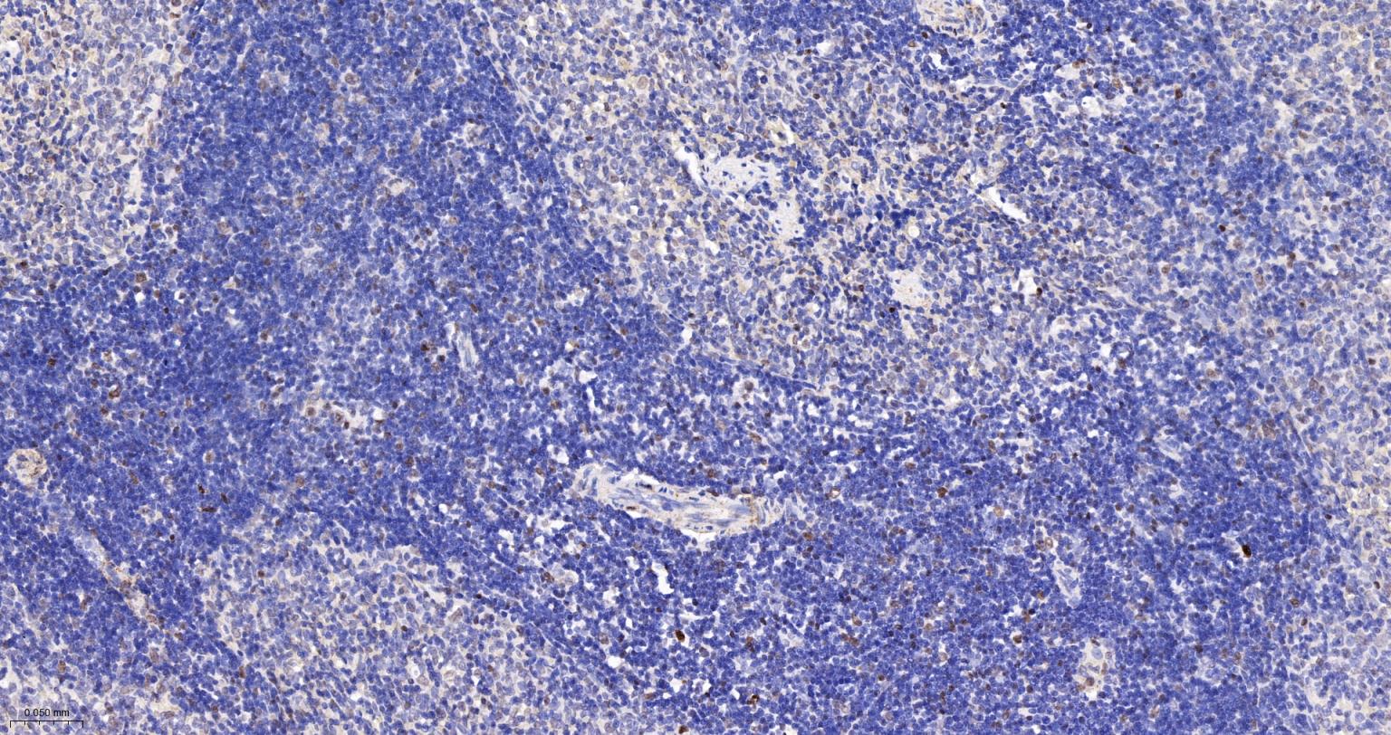 DNA甲基转移酶-3α重组兔单抗
