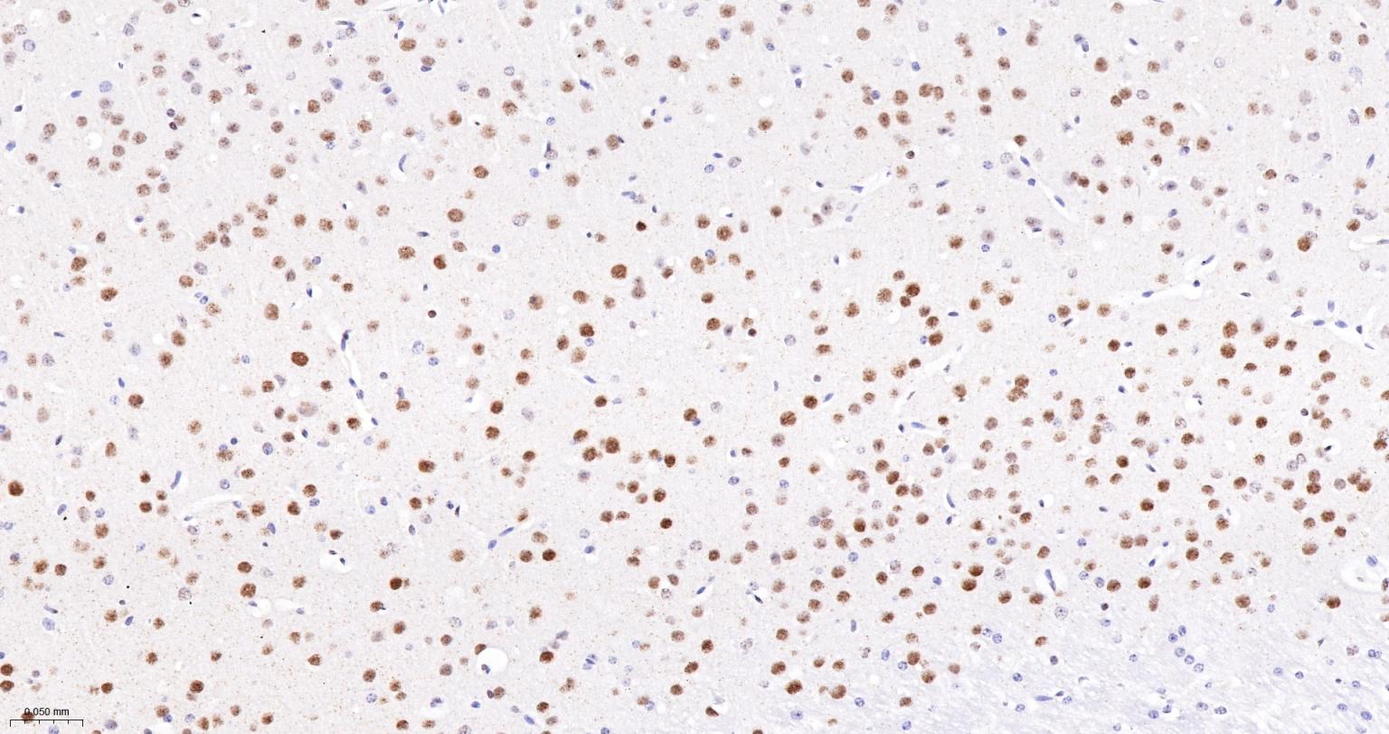 DNA解旋酶V重组兔单抗-bsm-60625R