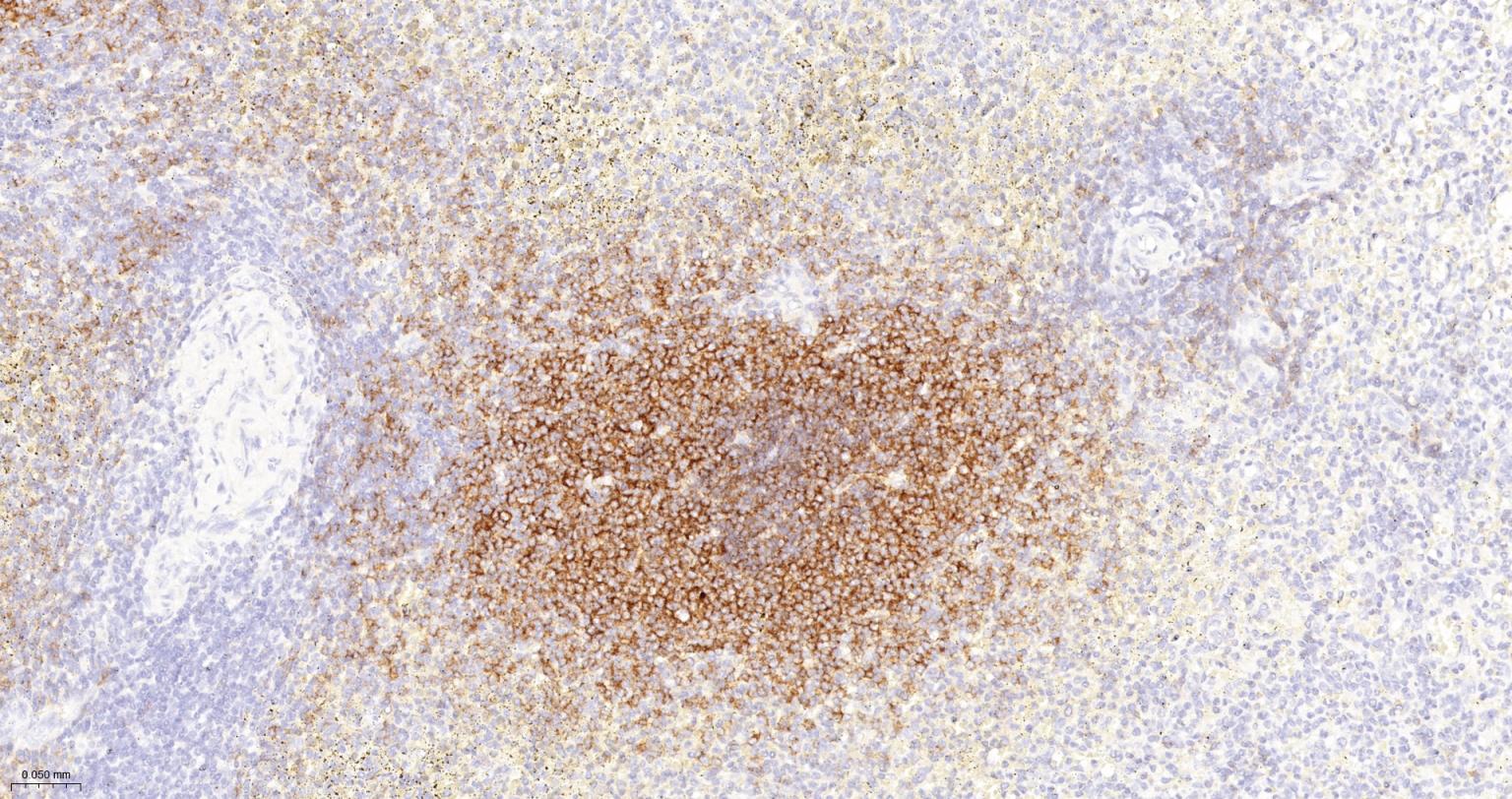 CD19重组兔单抗-bsm-60605R