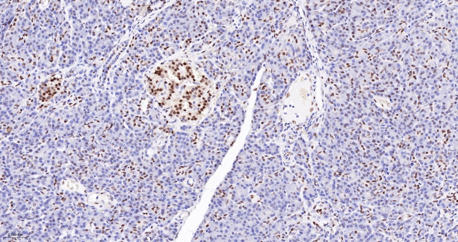 DNA解旋酶V重组兔单抗-bsm-60625R
