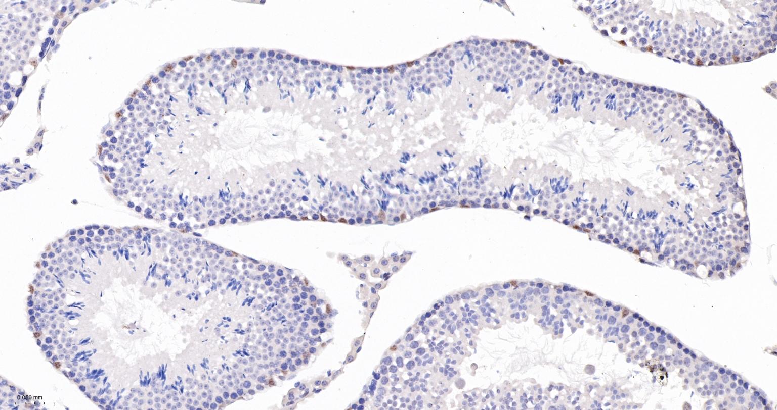 肾母细胞瘤蛋白重组兔单抗