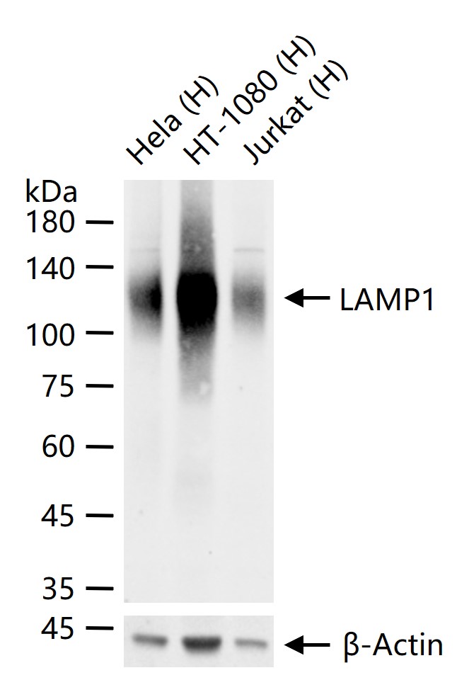 溶酶体相关膜蛋白1（CD107）重组兔单抗