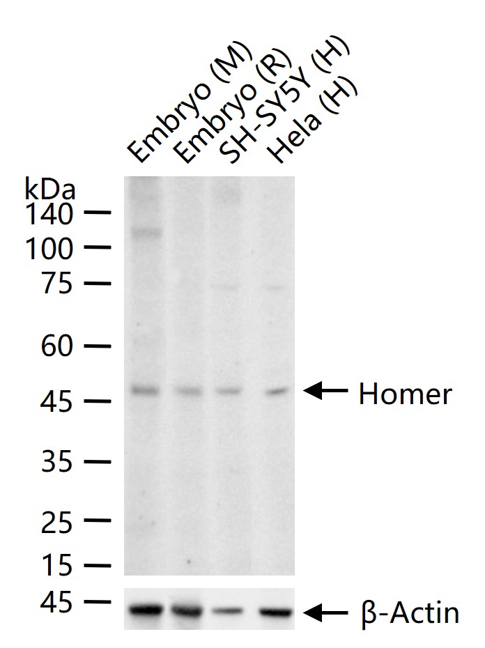 Homer Recombinant Rabbit mAb (一抗) - WB,IHC-P,IHC-F,IF,IP | Bioss