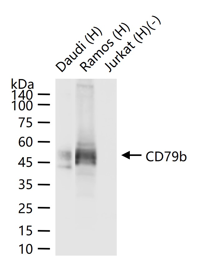 CD79b重组兔单抗