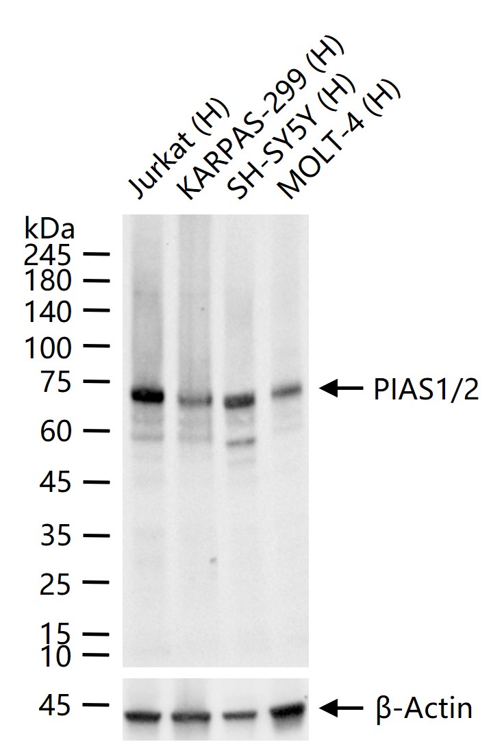 PIAS1/2 Recombinant Rabbit mAb (一抗) - WB,IHC-P,IHC-F,IF,Flow-Cyt,ICC/IF,IP | Bioss