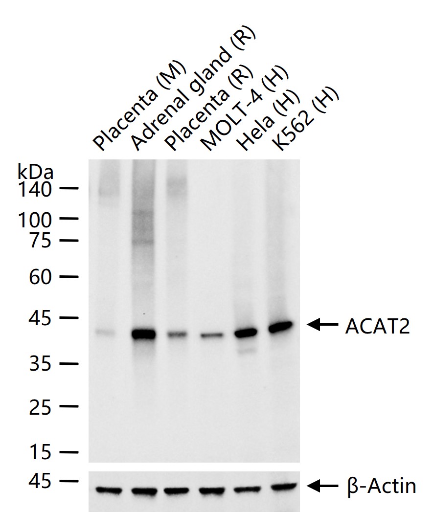 ACAT2重组兔单抗