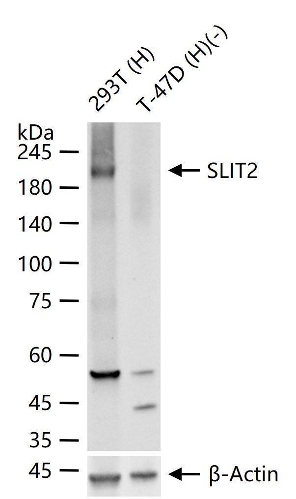 神经迁移蛋白Slit2/3重组兔单抗