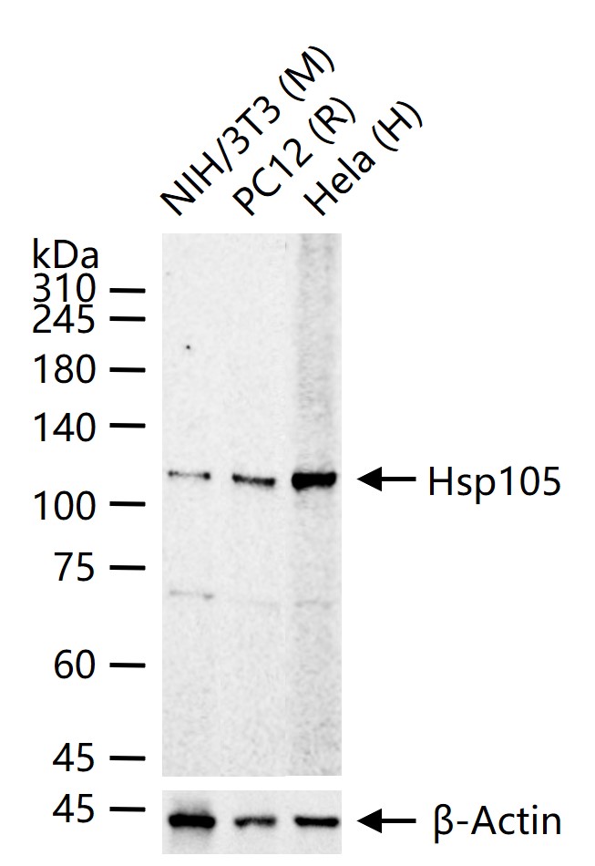 热休克蛋白105重组兔单抗