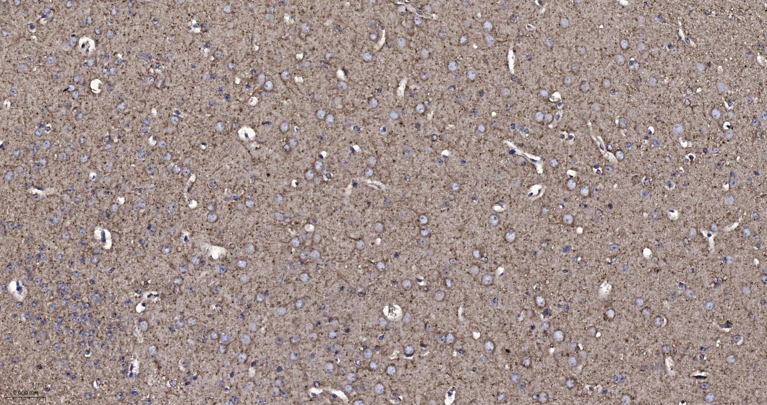 神经迁移蛋白Slit2/3重组兔单抗