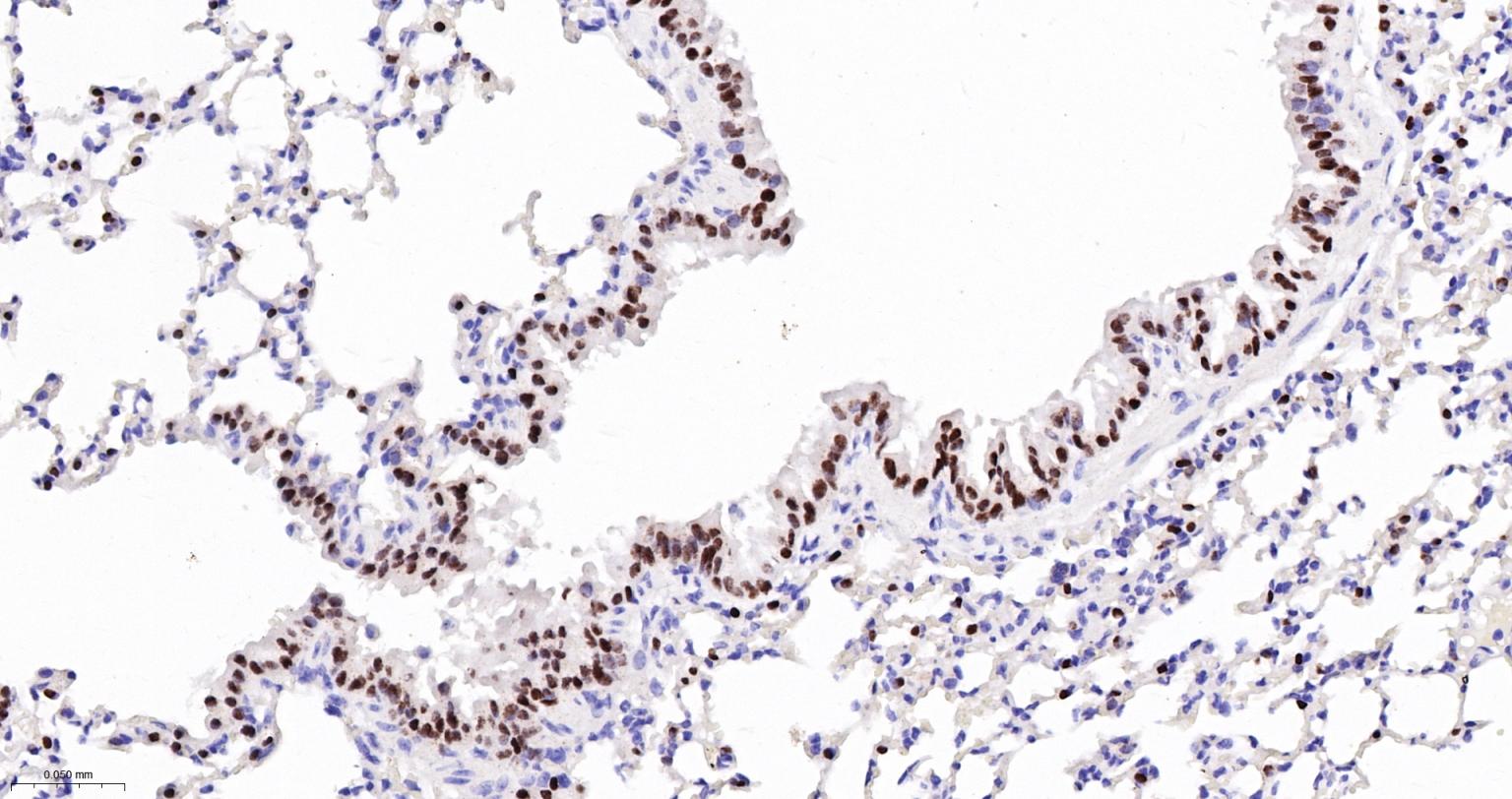 甲状腺核转录因子-1重组兔单抗