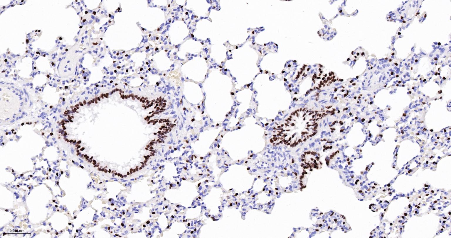 甲状腺核转录因子-1重组兔单抗