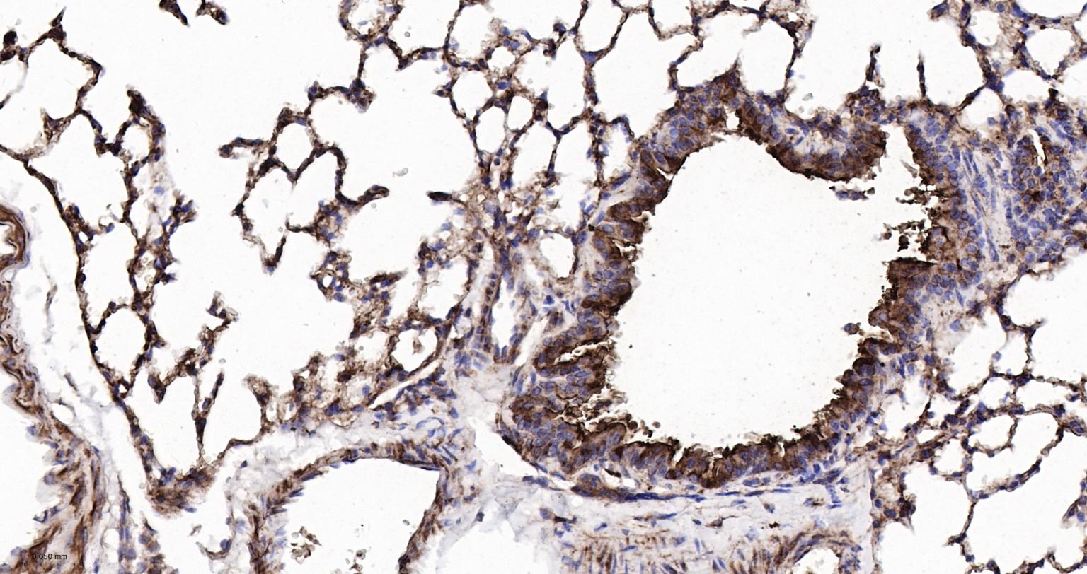 神经迁移蛋白Slit2/3重组兔单抗