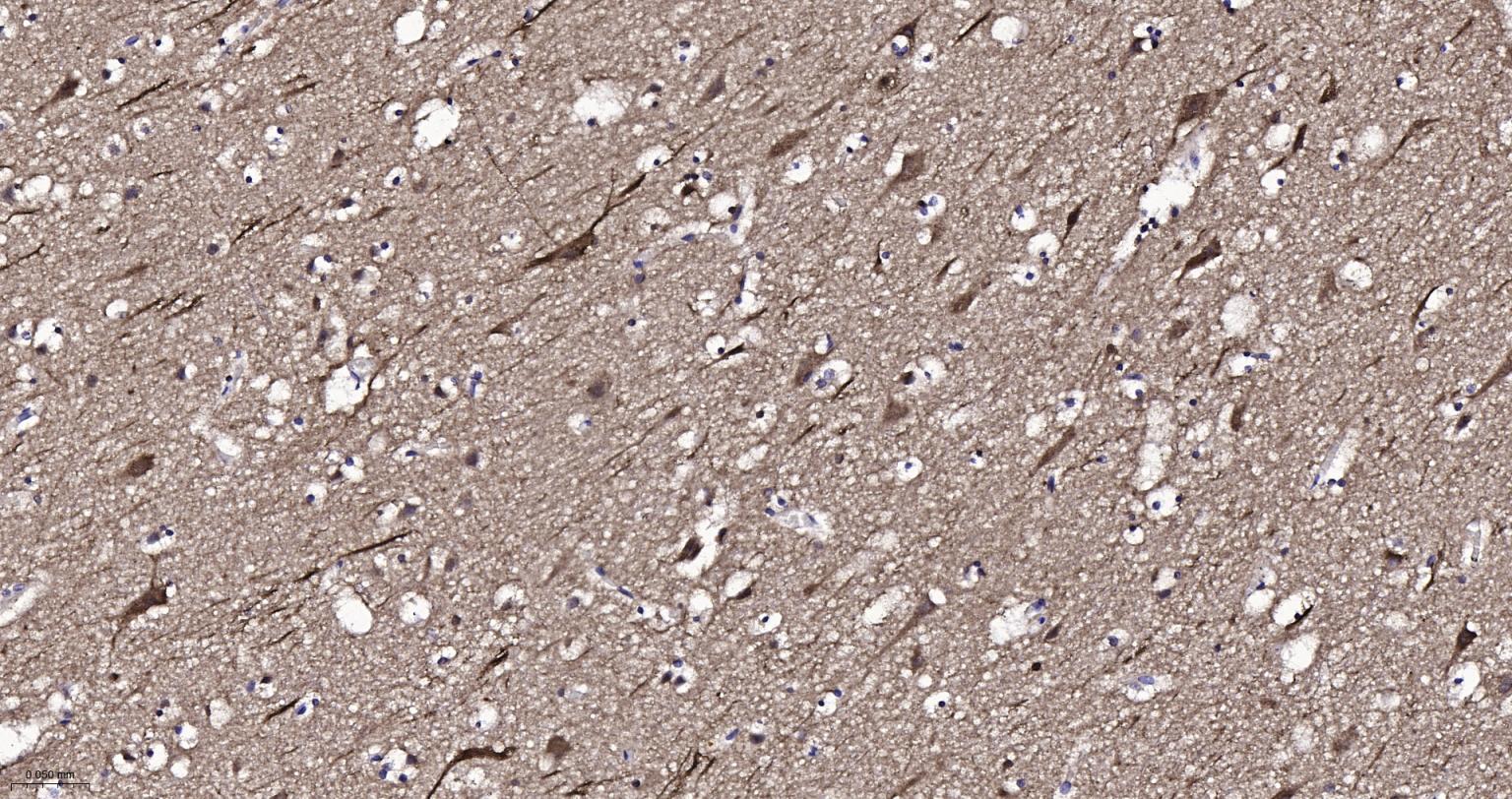 神经迁移蛋白Slit2/3重组兔单抗