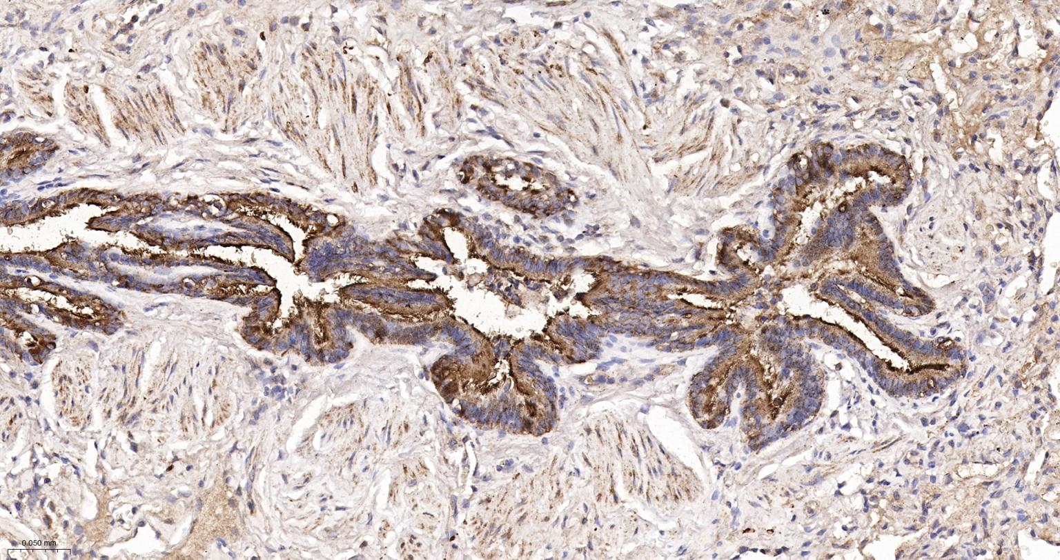 神经迁移蛋白Slit2/3重组兔单抗