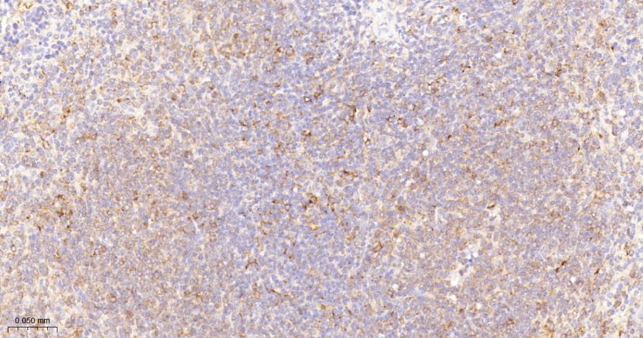 泛素结合蛋白P62抗体-bs-55207R