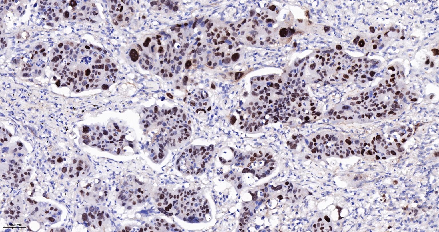 甲状腺核转录因子-1重组兔单抗