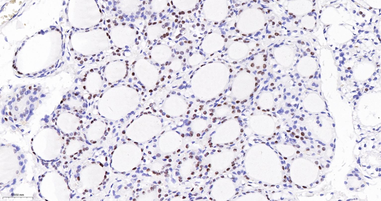 甲状腺核转录因子-1重组兔单抗