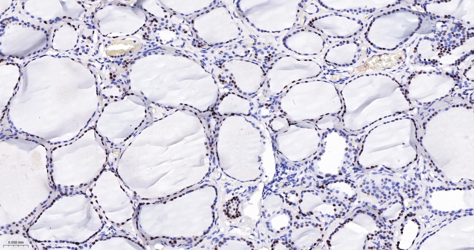 甲状腺核转录因子-1重组兔单抗