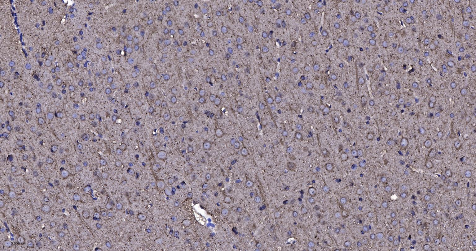 神经迁移蛋白Slit2/3重组兔单抗