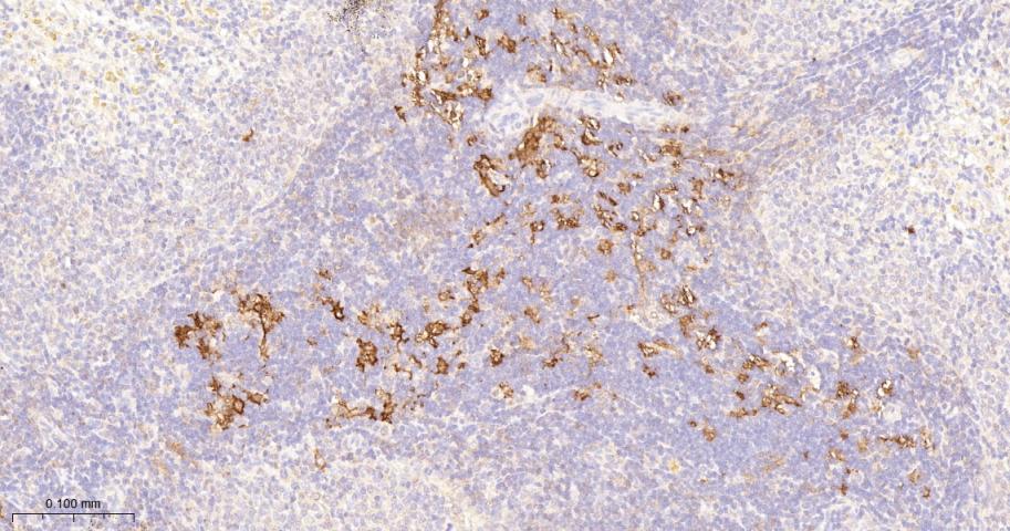 泛素结合蛋白P62抗体-bs-55207R