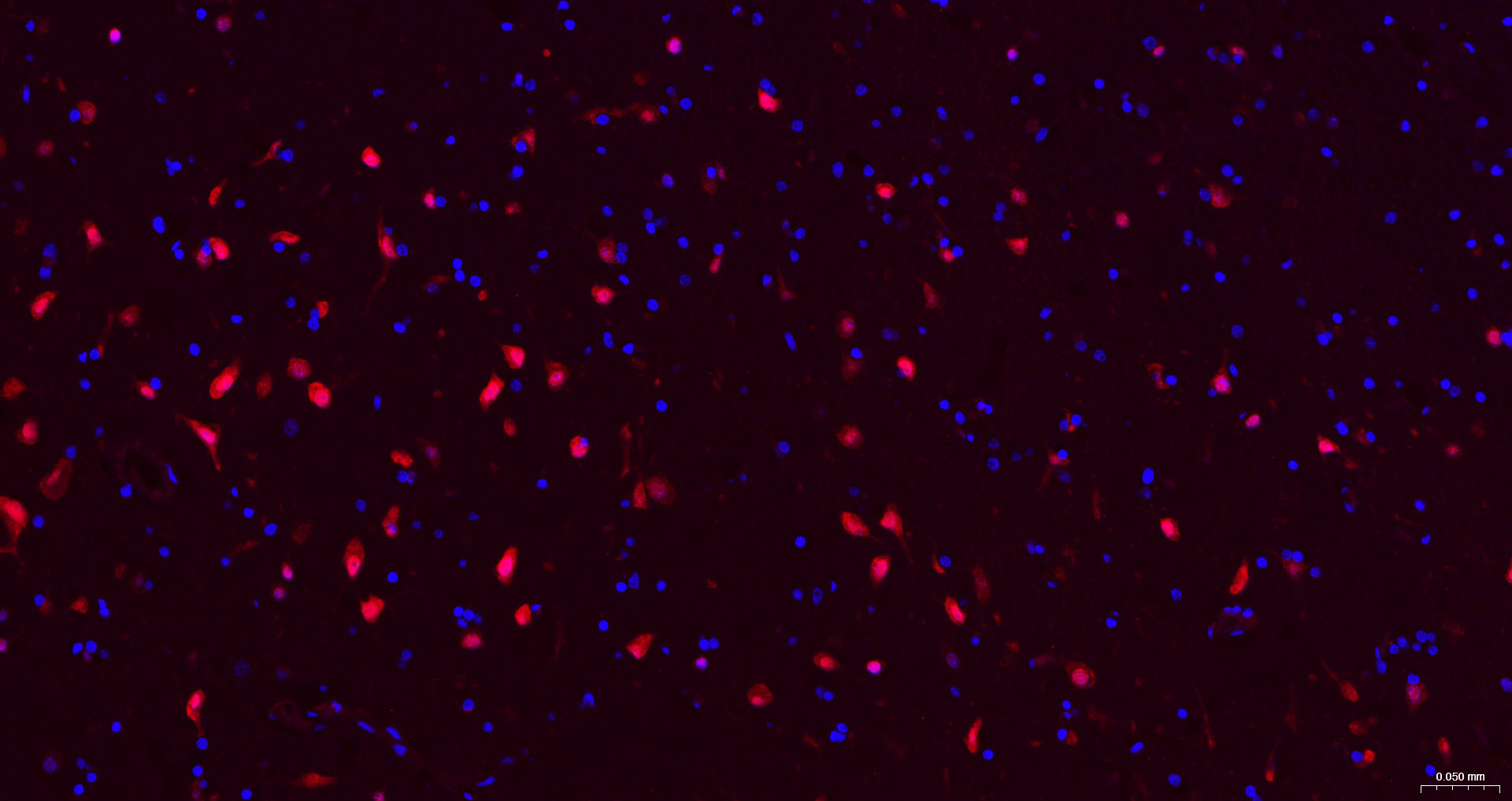 神经元核抗原重组兔单抗