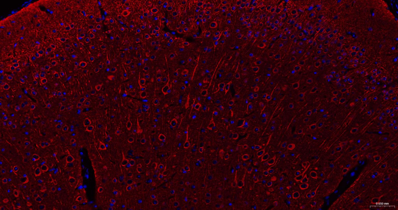 微管蛋白β3重组兔单抗